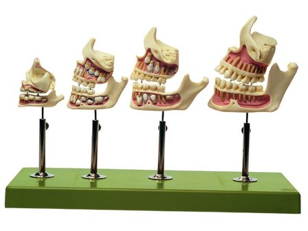 Gebitsontwikkeling in verschillende stadia