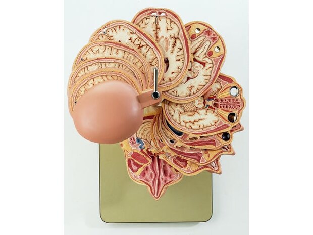 Doorsnedemodel hoofd, incl. CT- en MRI-beelden