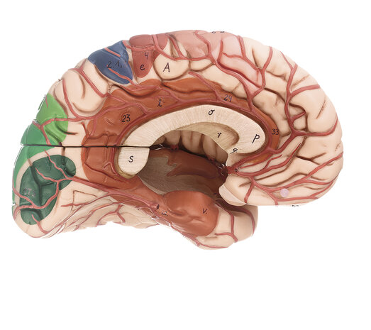 Hersenmodel met slagaders